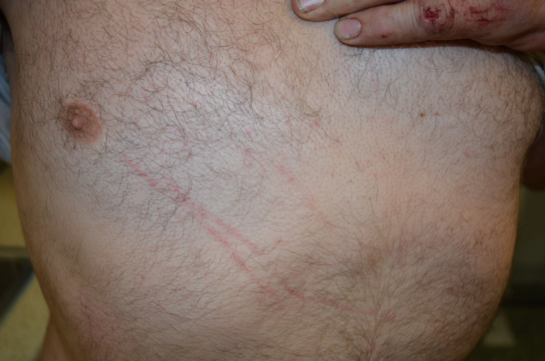 Todd Kendhammer's chest